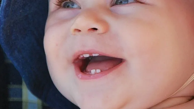 Photo of smiling baby boy with his first teeth for our article about teething symptoms